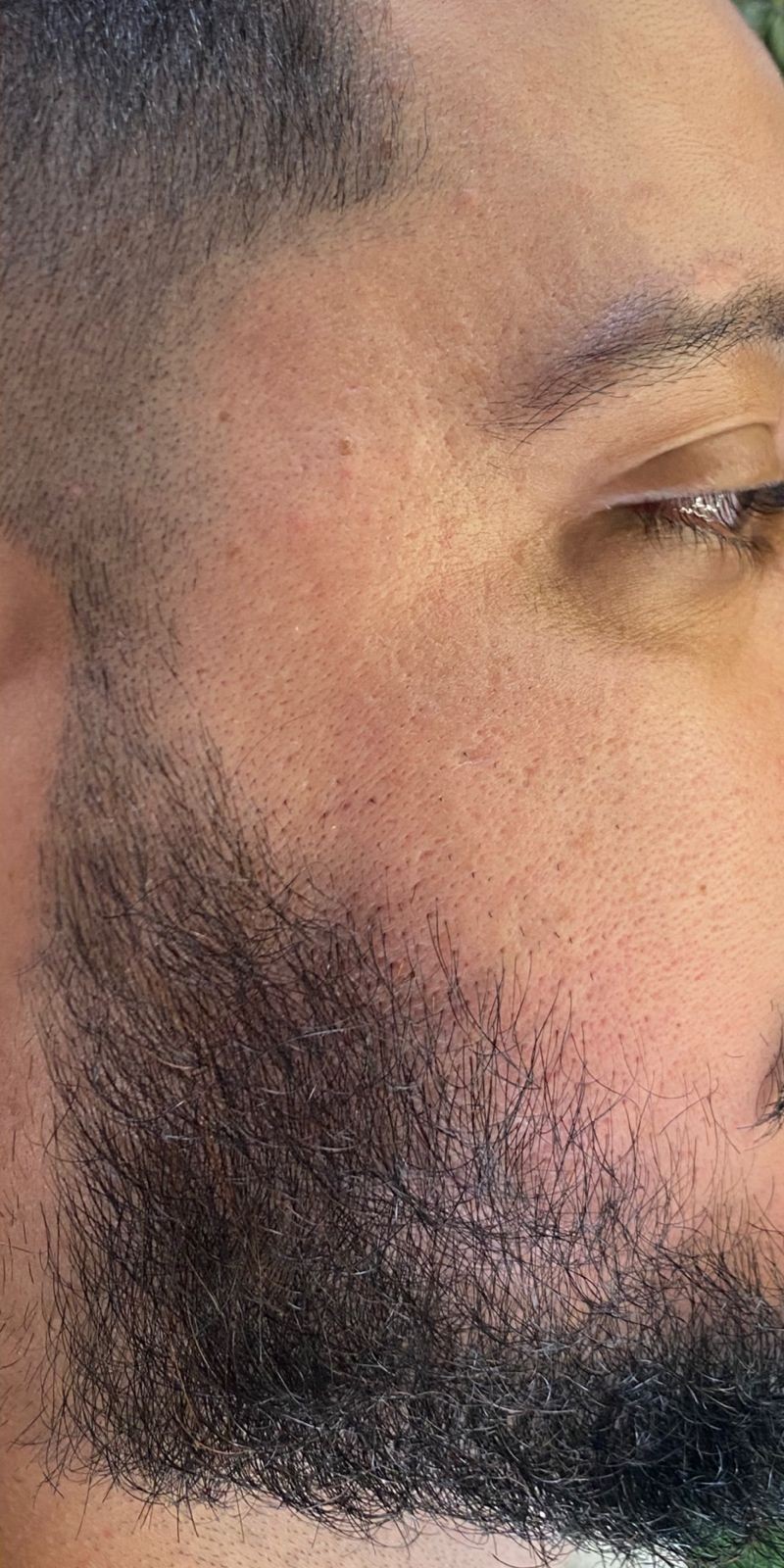 Resultado autorizado de acompanhamento de barba