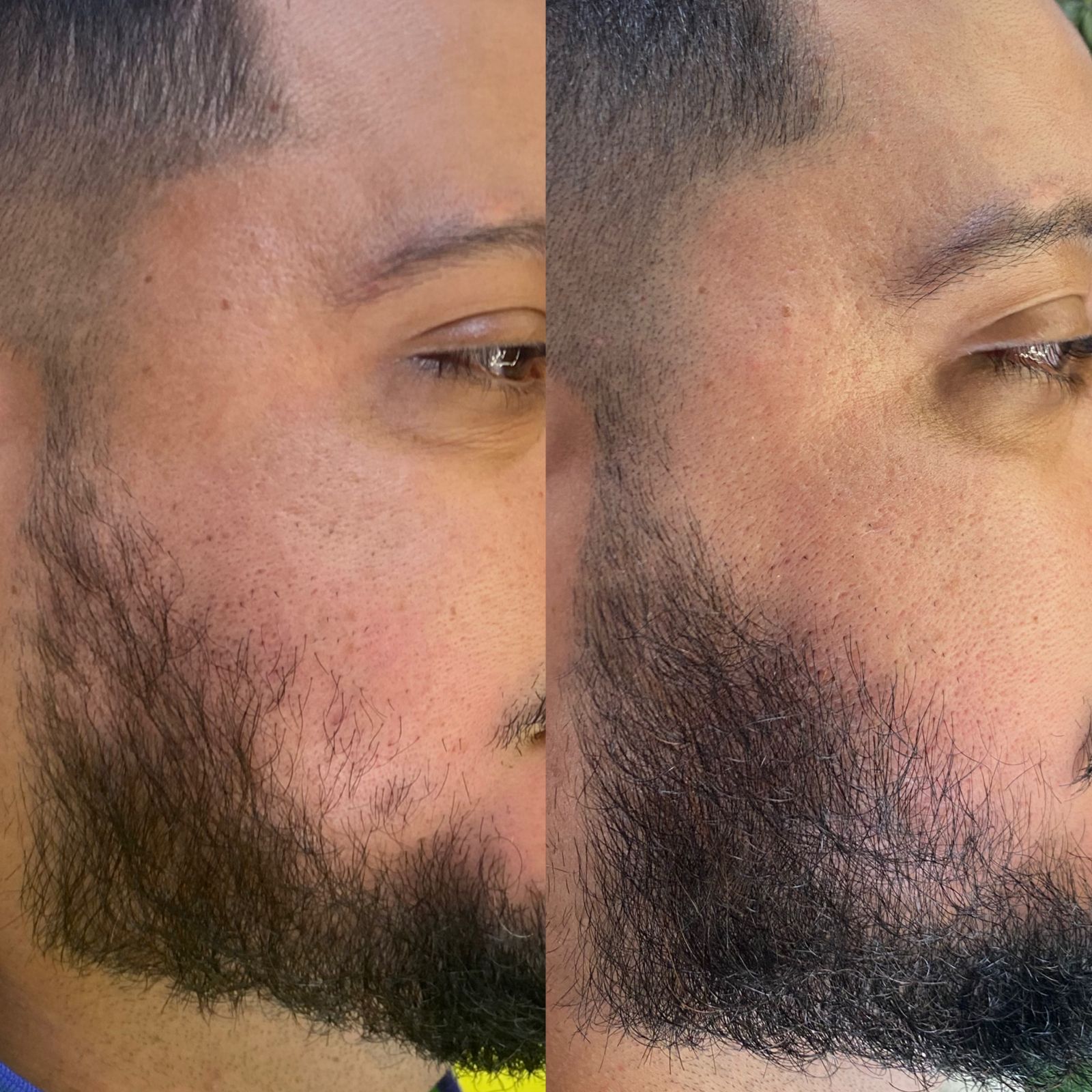 Registro autorizado de acompanhamento de falhas na barba